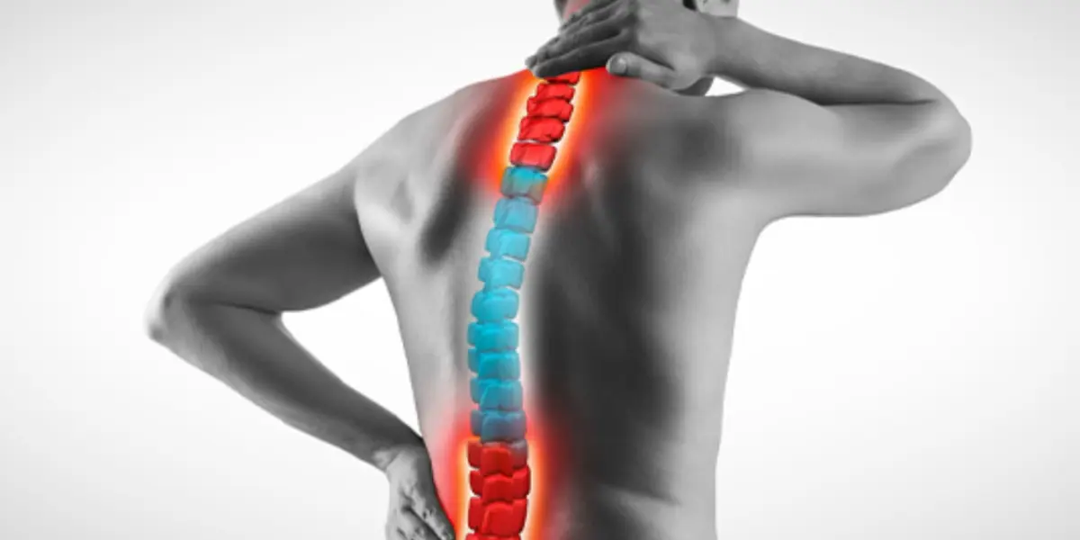 bico de papagaio na coluna