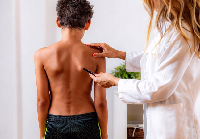 Deformidades Pediátricas na Coluna: causas, sinais e tratamento